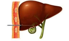 biliary-1