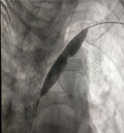 renal-10
