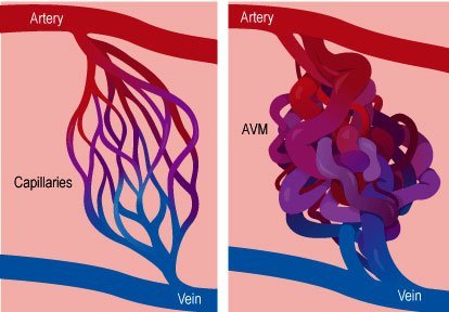 vascular-2