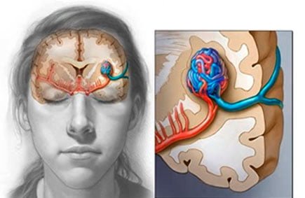 vascular-3