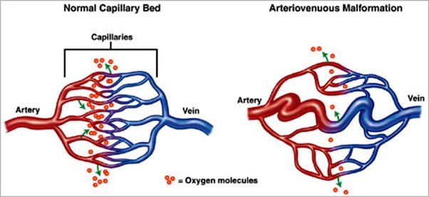 vascular-4