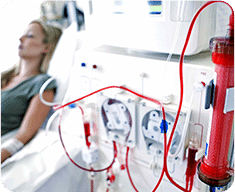 Dialysis Access Catherization