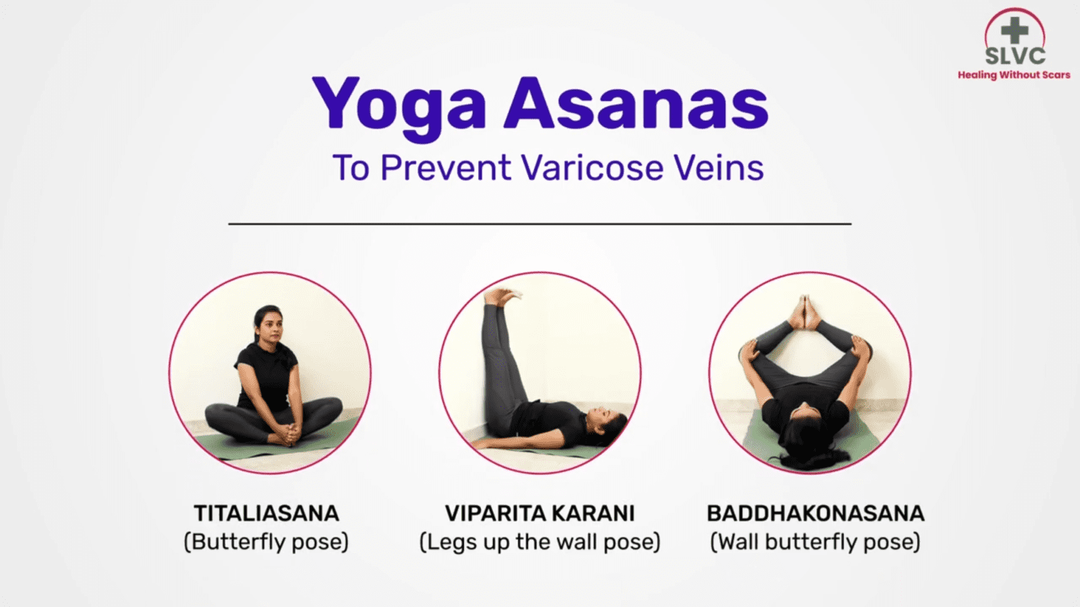 The Importance Of Exercise And Yoga In Managing Varicose Veins