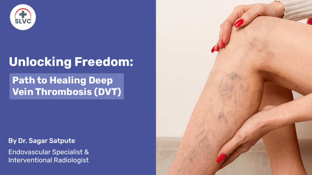 Unlocking Freedom: Dr. Sagar Satpute's Path to Healing Deep Vein Thrombosis (DVT)