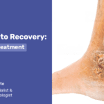 The Road to Recovery: Leg Ulcer Treatment2
