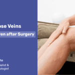 Can Varicose Veins Re-occur even after Surgery2
