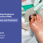 Understanding Peripheral Artery Disease (PAD): Causes, Symptoms, and Treatment2