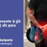 Varicocele: Causes, impact on male infertility, treatment and prevention tips