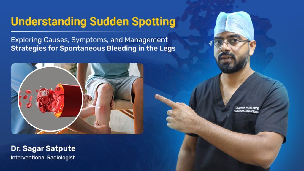 What Causes Sudden Bleeding in the Legs? Exploring Symptoms and Management Strategies.