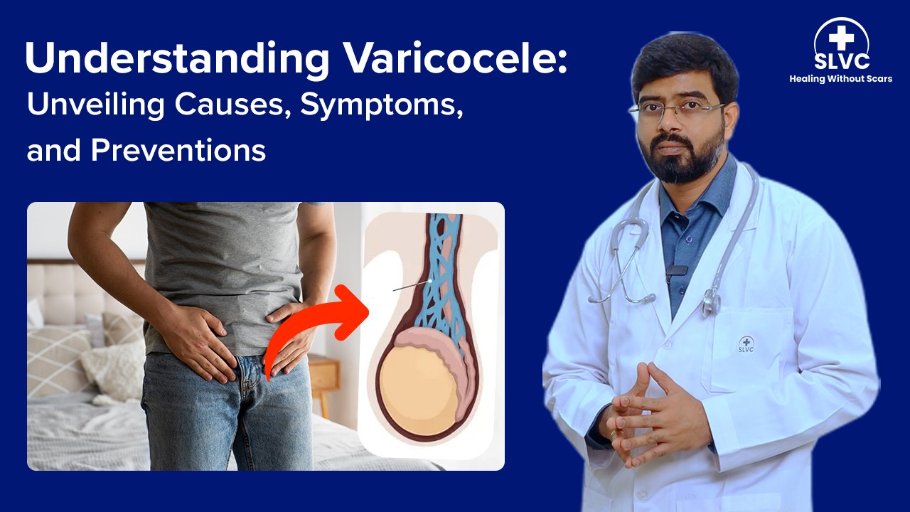 Understanding Varicocele Unveiling Causes Symptoms And Preventions